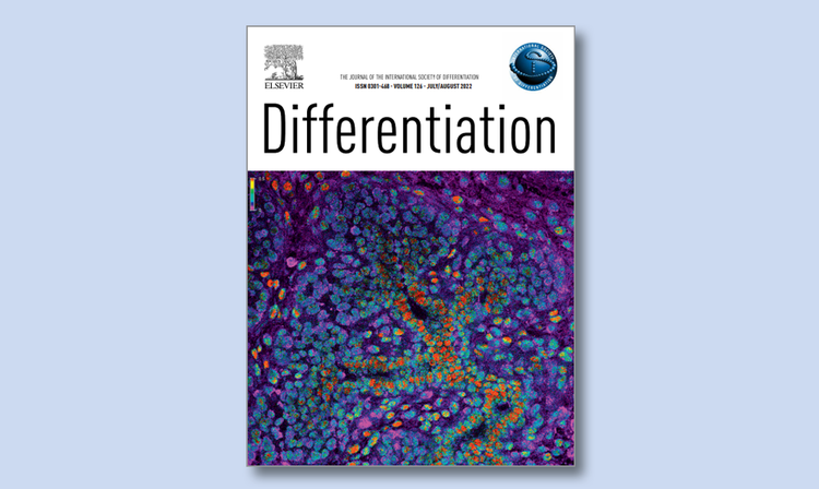 Differentiation Cover on a Blue Background