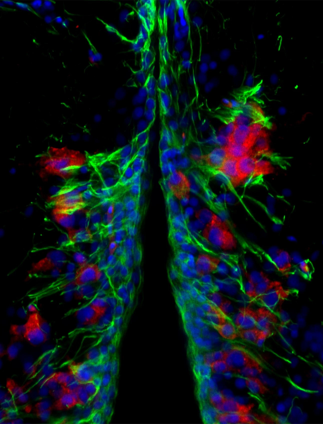 Zebrafish